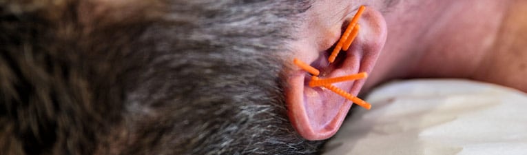 Picture of a patient laying on an examination table with acupuncture needles inserted in their earlobe.